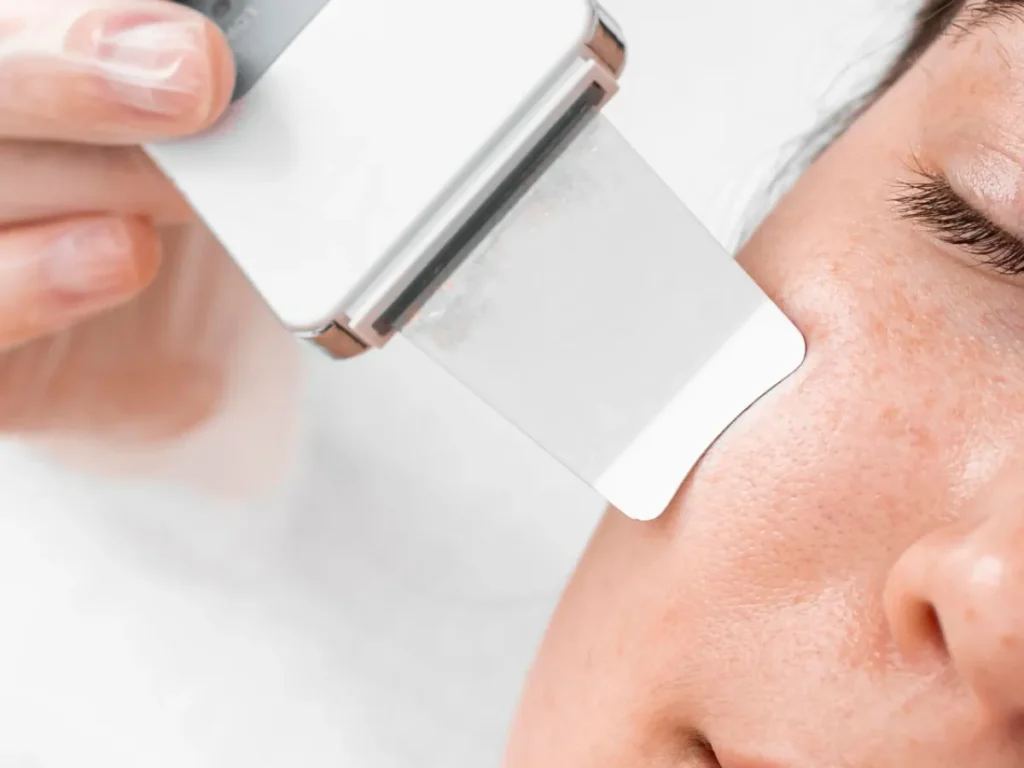 Ultrasonic spatula cleaning pores on cheek