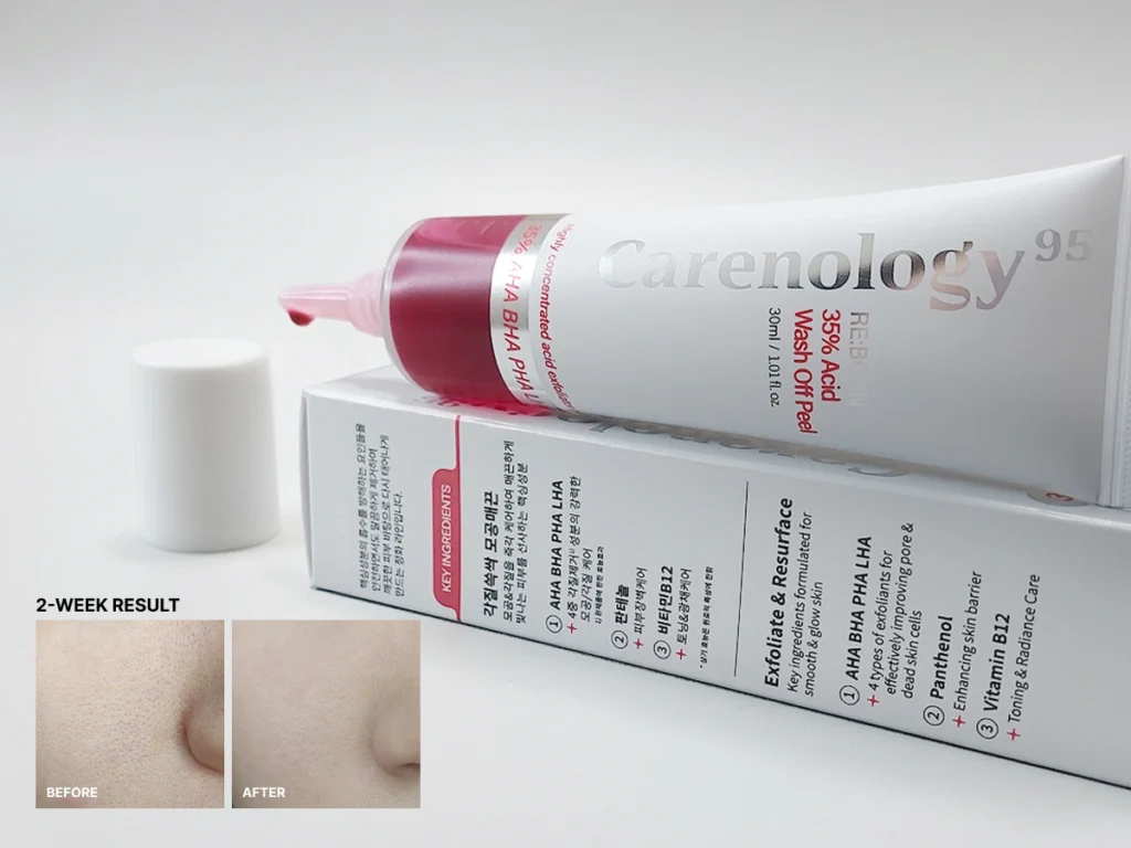 Carenoloy Reborn 35% Acid Wash Off Peel