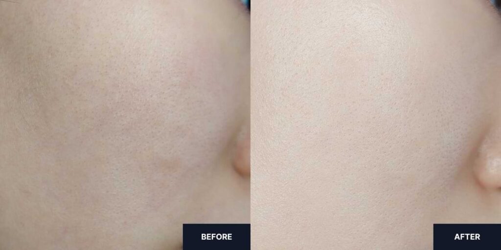 Before and after 2 weeks of using Primera Youth Radiance Power Moisturizing Cream