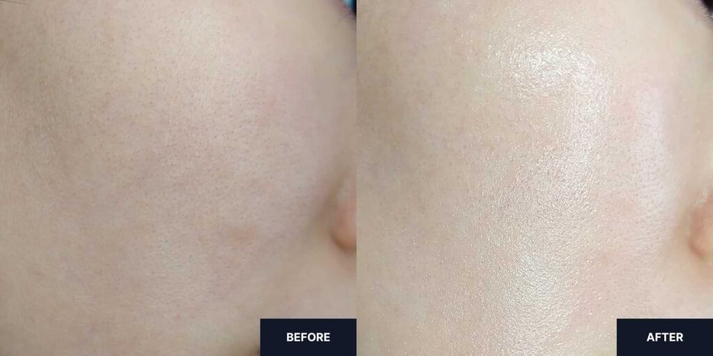 Before and after applying the Primera Youth Radiance Power Moisturizing Cream